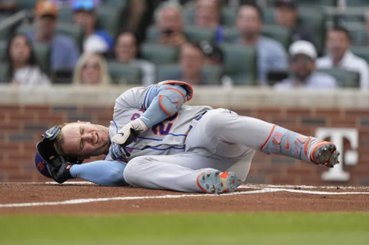 MLB homer leader Pete Alonso to IL with bone bruise, sprain in wrist